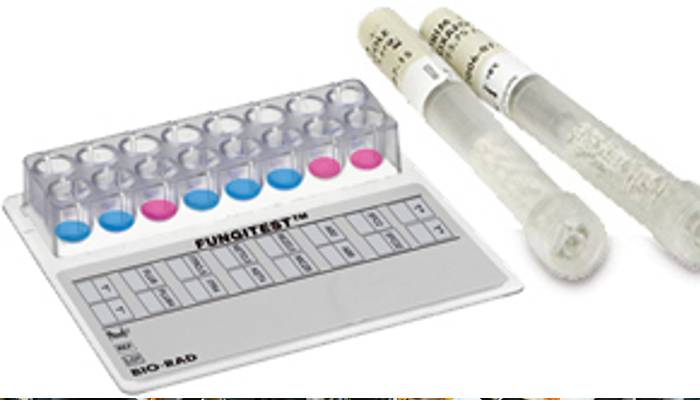 Antifungal Susceptibility Testing से कारगर दवाइयों का चलेगा पता, बीमारियों का इलाज होगा आसान