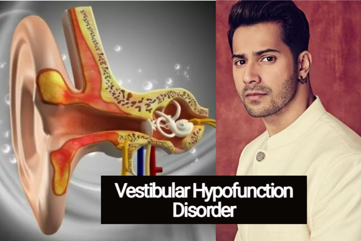 Vestibular Hypofunction बीमारी से जूझ रहे एक्टर वरुण धवन, जानें इसके लक्षण व बचाव