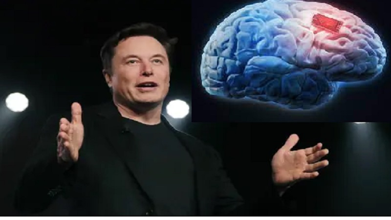 Elon Musk की कंपनी का लक्ष्य जल्द ही लोगों में ‘Brain implant’ का परीक्षण करना