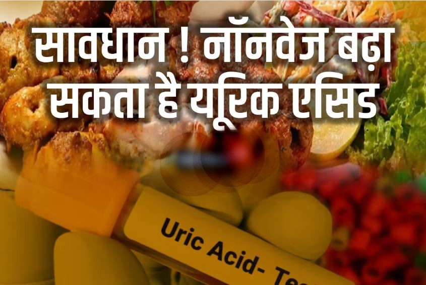 नॉनवेज खाने के हैं शौकीन तो हो जाएं सावधान, हर उम्र के लोगों में बढ़ रही यूरिक एसिड की समस्या