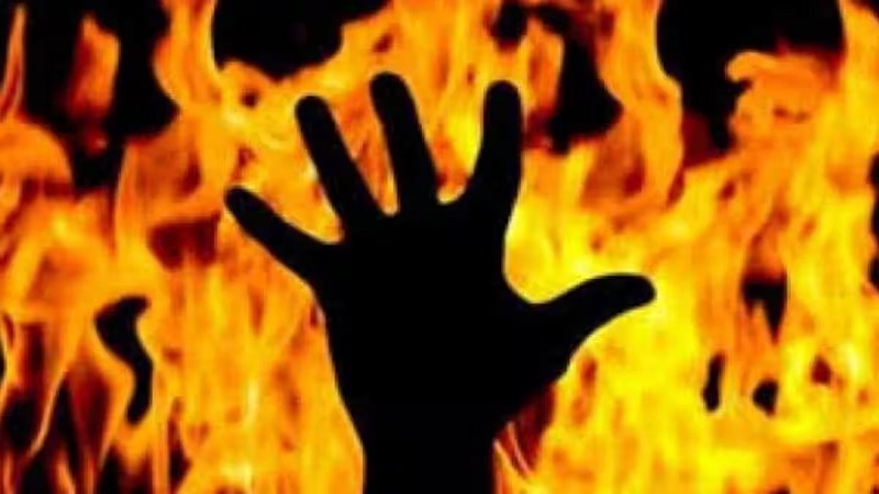 रामपुर: जलते कूड़े के ढेर में गिरी सात वर्षीय मासूम, 95 फीसदी जलने से मौत