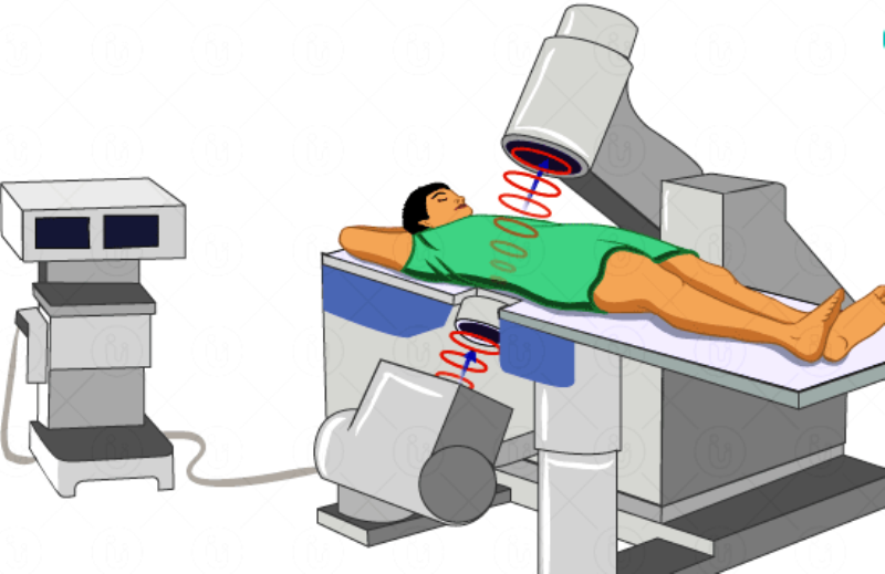 हल्द्वानी: 2.99 करोड़ की लिथोट्रिप्सी मशीन 9 साल से फांक रही धूल, केवल 15 मरीजों का ऑपरेशन कर लग गया पूर्णविराम