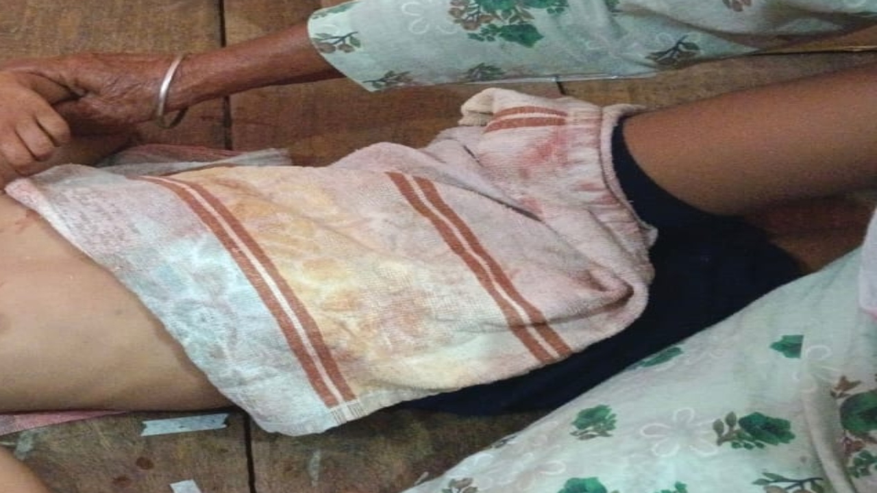 बहराइच: तेंदुए के हमले में बालक घायल, लखनऊ रेफर