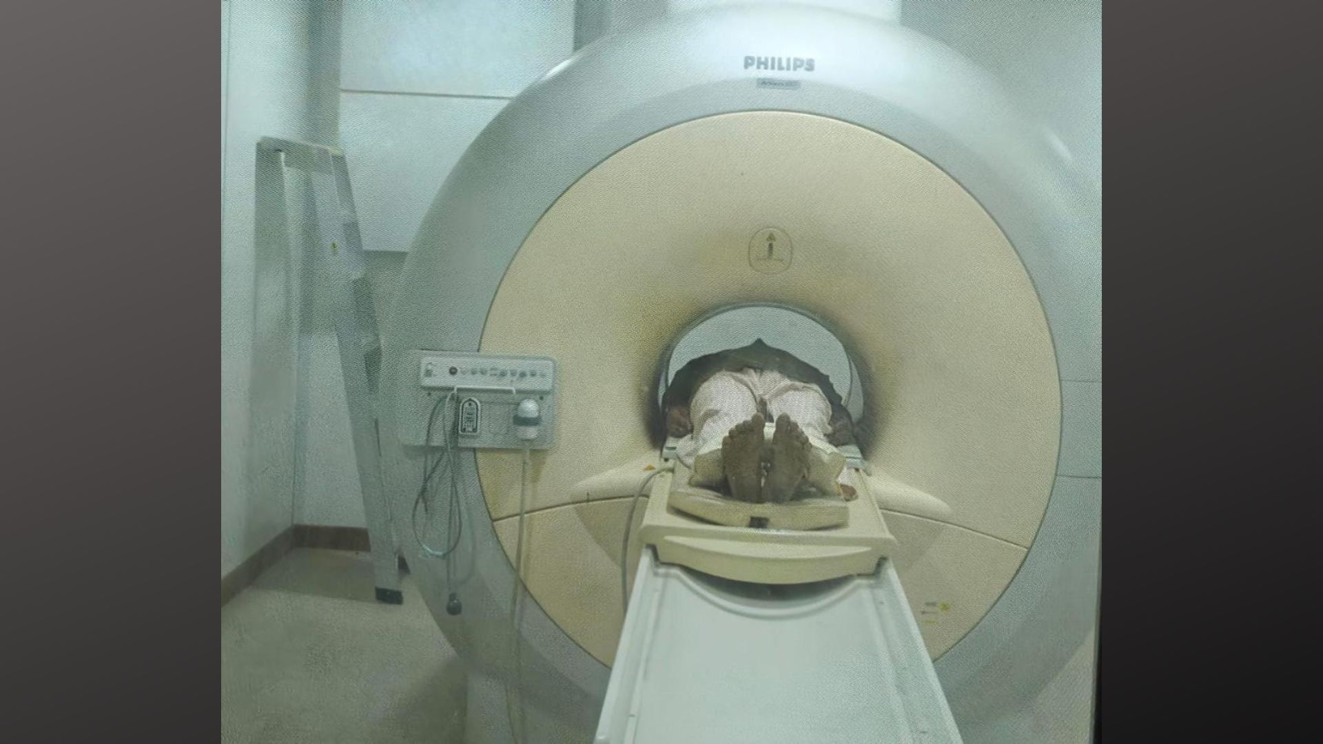 प्रयागराज: SRN अस्पताल में MRI मशीन ने बदली हजारों की जिंदगी, 8 वर्ष में 20 हजार मरीजों को मिला लाभ