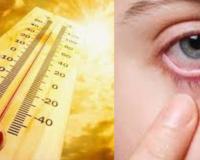बरेली: गर्मी में आंखों के संक्रमण के मामले बढ़े, डॉक्टरों ने धूप से बचाव की दी सलाह 
