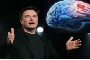 Elon Musk की कंपनी का लक्ष्य जल्द ही लोगों में ‘Brain implant’ का परीक्षण करना