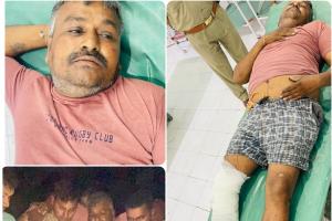 Hamirpur Crime : हिस्ट्रीशीटर ने दरोगा पर किया था फायर, पुलिस मुठभेड़ में दोनों पैरों में लगी गोली, बदमाश घायल