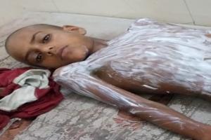 बहराइच हादसे: एसिड गिरने से बालक झुलसा, करंट से ग्रामीण की मौत 