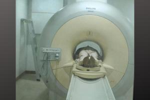 प्रयागराज: SRN अस्पताल में MRI मशीन ने बदली हजारों की जिंदगी, 8 वर्ष में 20 हजार मरीजों को मिला लाभ